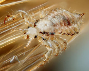 Head lice attacking hair