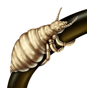 Illustration of head lice