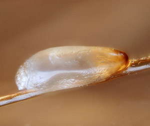 Head louse egg