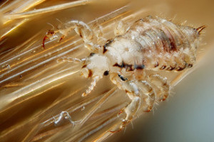 close up of head louse
