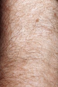 hairy-arm