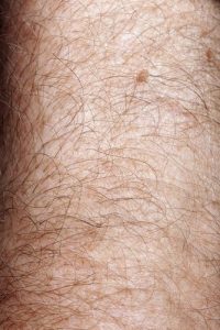 hairy-arm